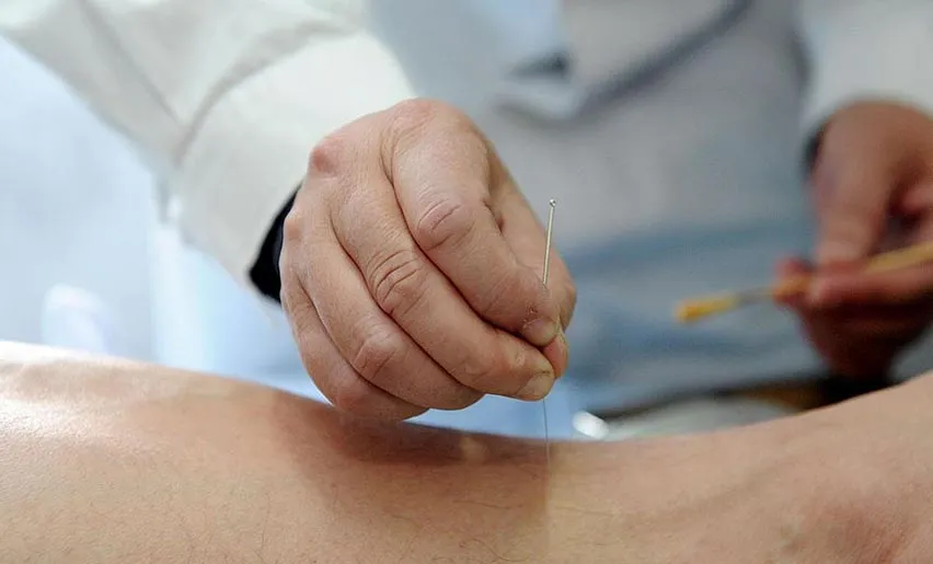 Traditional Chinese Acupuncture Traditional Chinese Acupuncture